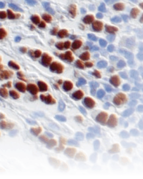 Immunohistochemical (IHC) Dection Systems & Kits