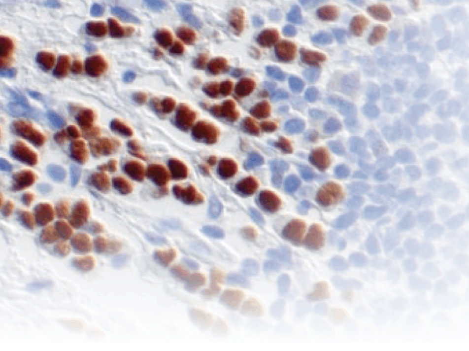 Immunohistochemical (IHC) Dection Systems & Kits
