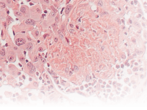 Comprehensive IHC Antibody Portfolio for Your Research and Clinical Needs